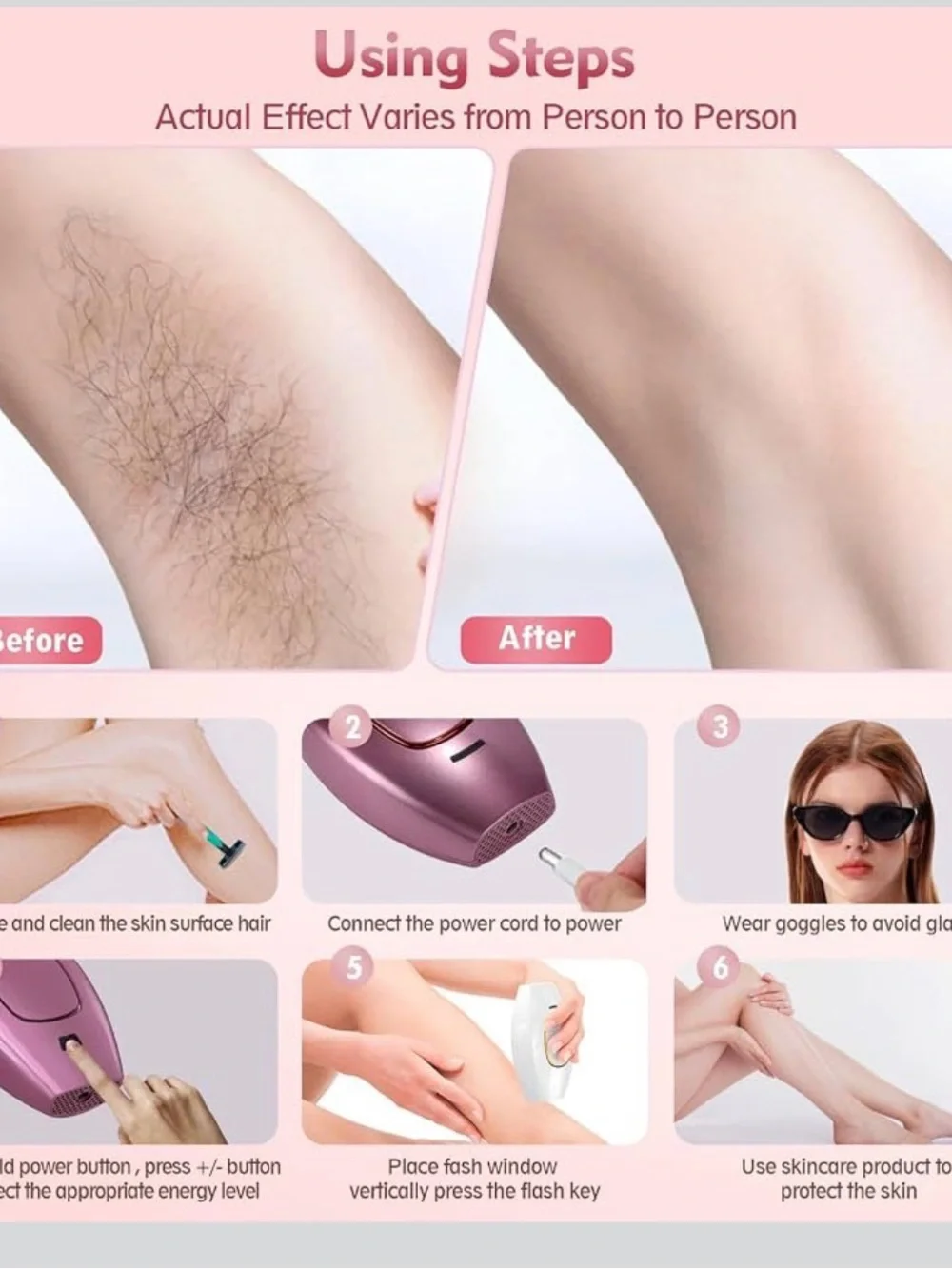 White and Gold IPL Hair Removal Device - Professional Home Use